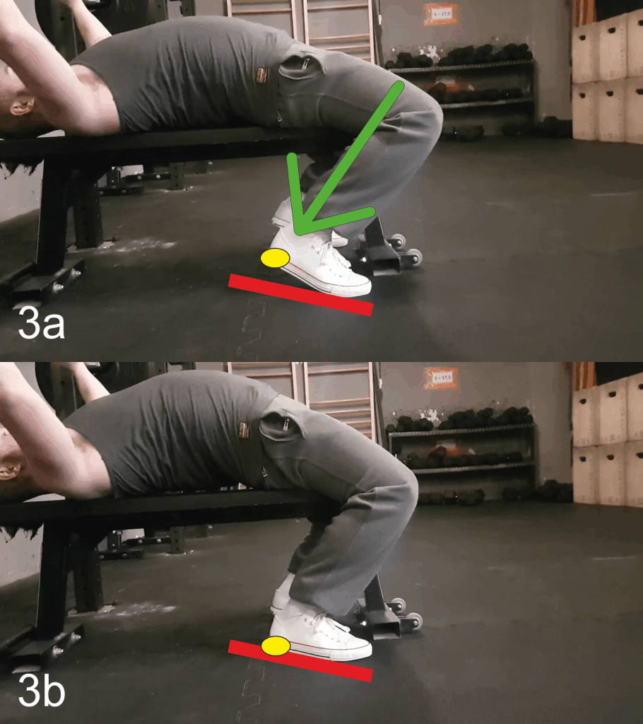 leg drive procedura