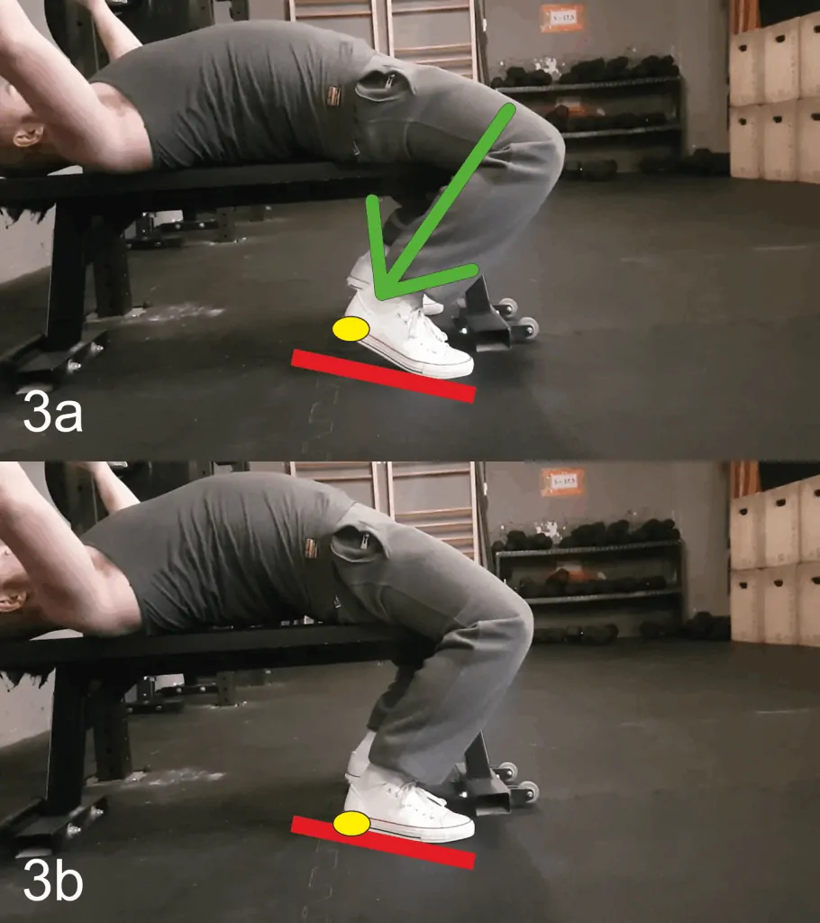 leg drive procedura